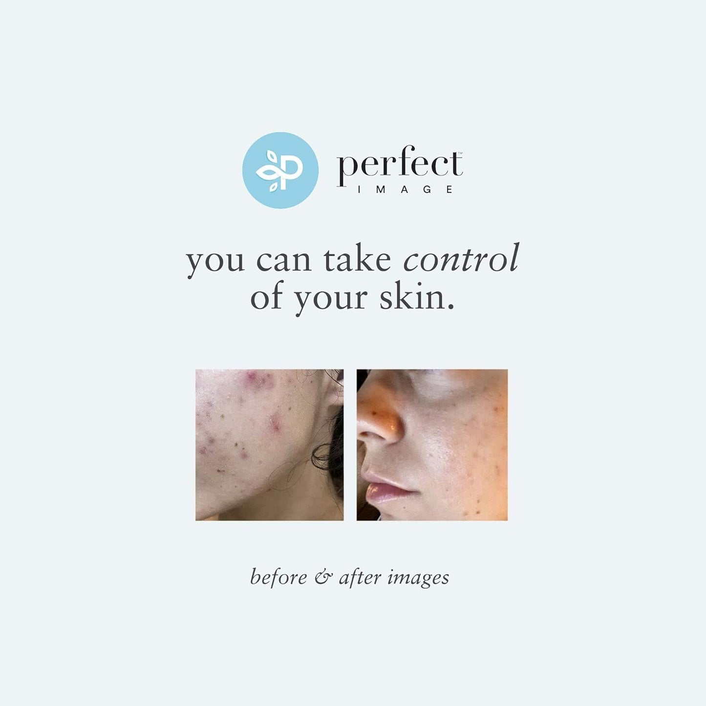 Tri-Clarity | Peel Pads with Salicylic Acid & Tea Tree Oil - 25% Strength for Clear Skin