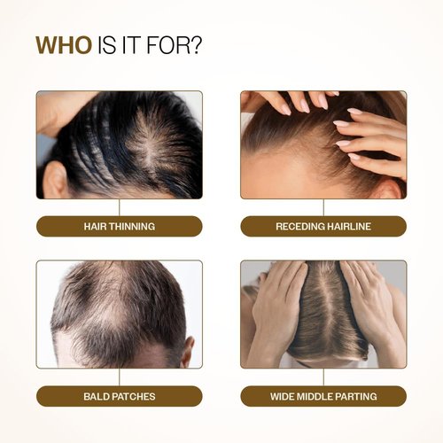 Bare Anatomy Advanced Hair Density Roll-On - 3% Redensyl, 4% Anagain & 5% Rosemary | Reduces Hair Fall & Supports Growth | 25ml