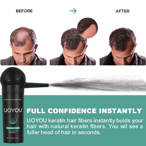 Hair Building Fibers for Thinning Hair for Men & Women 27.5g Bottle with Applicator | Fill In Thinning and Fine Hair for an Instantly Fuller, Thicker Look | Keratin Hair Fibres [BLACK Hair Fiber]