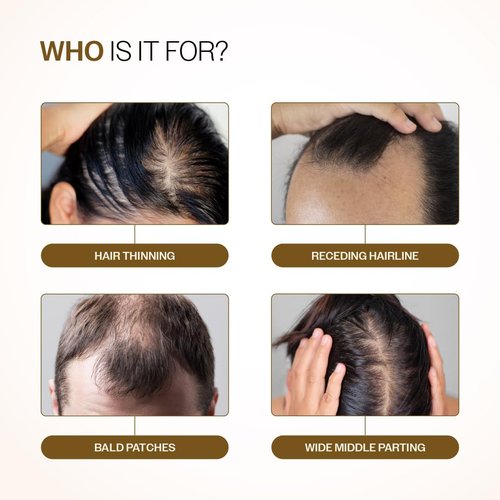 Bare Anatomy Advanced Hair Growth Serum Roll-On - 3% Redensyl, 4% Anagain & 5% Rosemary | Reduces Hair Fall & Promotes Growth | 25ml