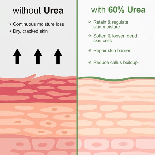 Regine Switzerland Urea Cream 60% - Intensive Foot Moisturizer with Salicylic Acid & Tea Tree Oil | 5.29oz
