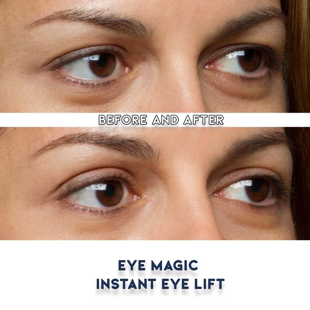 Eye Magic Combo Pack: 128 Eyelid Lift Strips - 64 Regular & 64 Large Sizes | Non-Surgical Eyelid Lift Solution for Natural Looking, Youthful Eyes