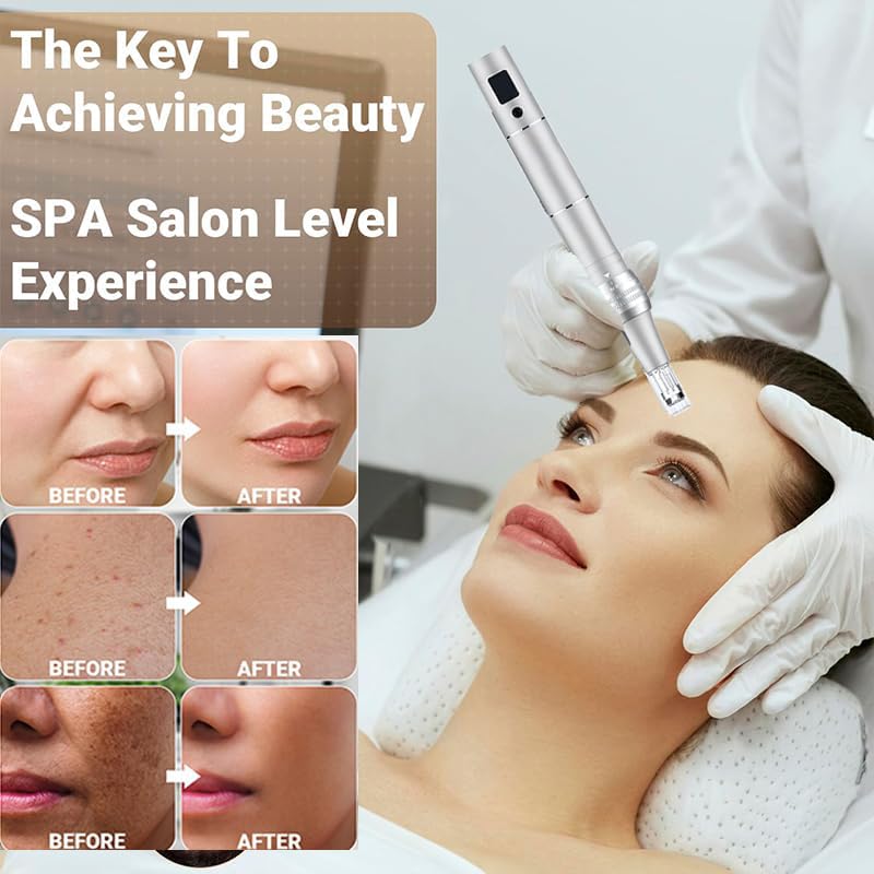 Microneedling Pen - Professional Microneeding 0.25 Mm Beauty Tools, Microneedles Roller Pen Grooming Tools For Women And Men