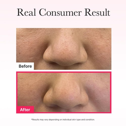 ARENCIA Red Collagen Jello Mask - Plump & Hydrating Hydrogel Mask for Dry Skin | 4 Pack with Collagen & Peptides
