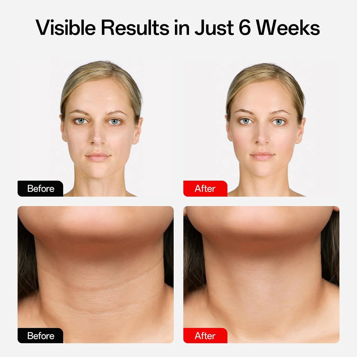 Facego Red Light Mask - Rechargeable Portable Face & Neck Treatment | 7 Color Options (Black)