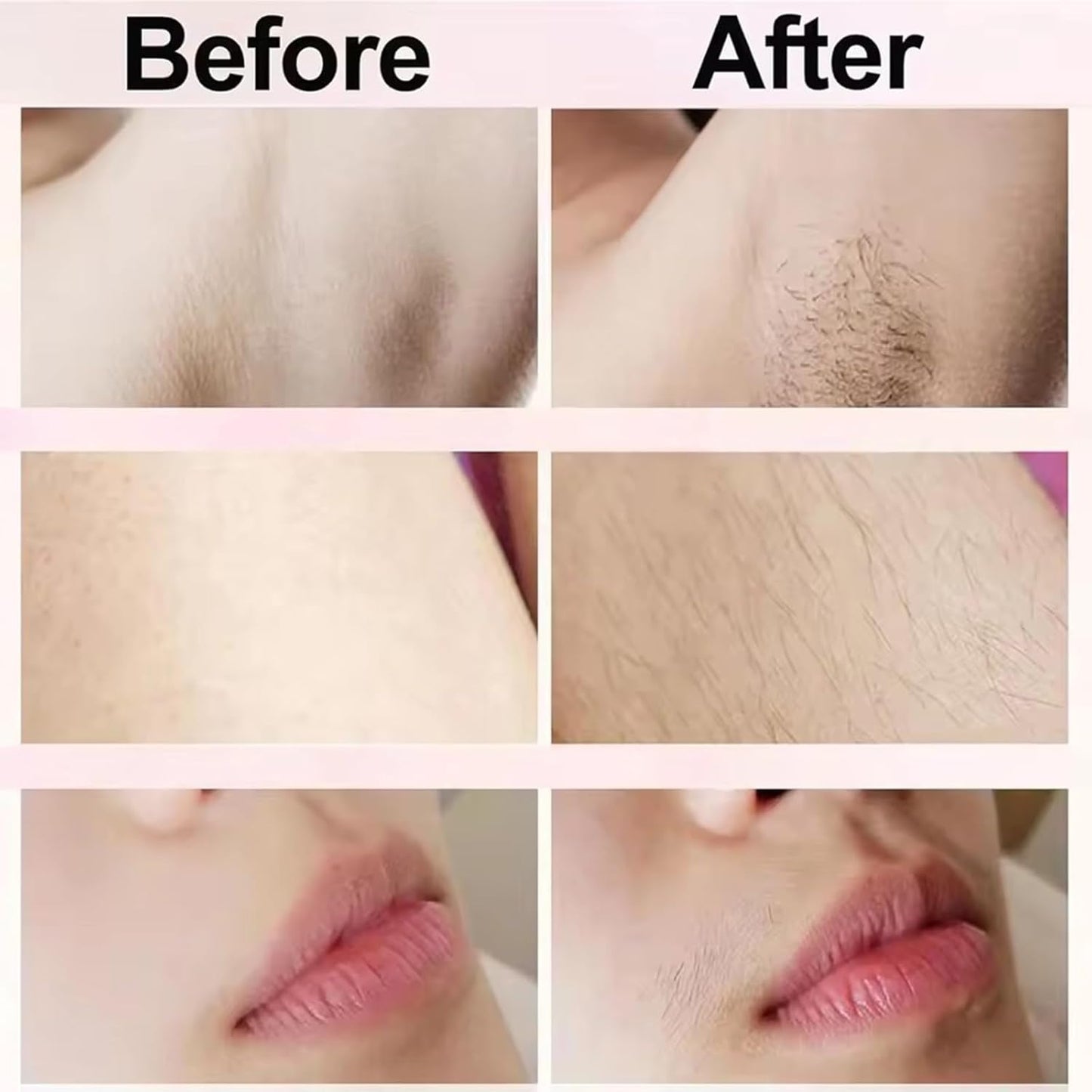 Skiennix Bikini Trimmer - 2-in-1 Cordless & Waterproof Electric Shaver for Women | Painless Hair Removal in Purple