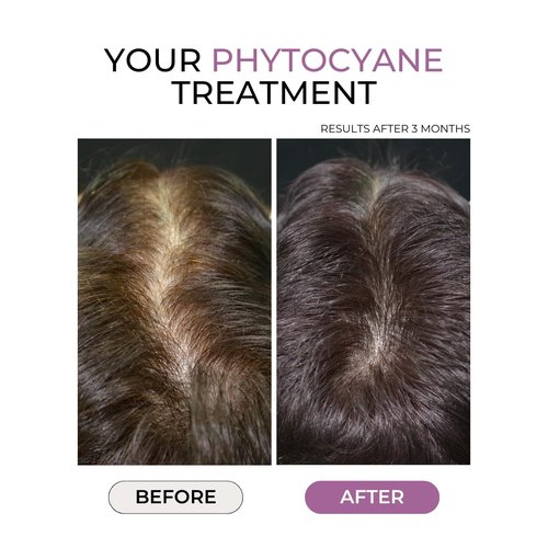 PhytoCyane Anti-Hair Thinning Dietary Supplement - 84 Vegan Capsules for 12-Week Supply