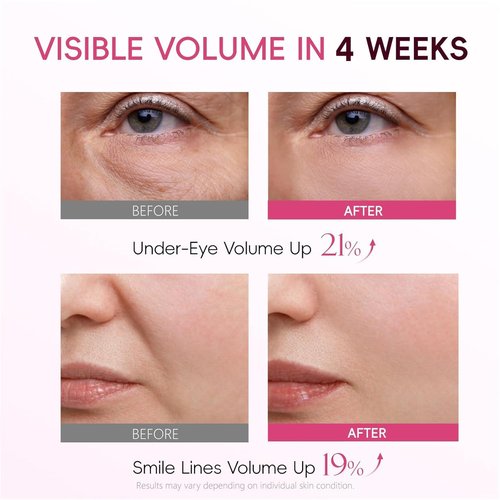 APBM Volufiline Plumping Serum - 5% Volufiline, 3% Niacinamide & 1% Multi-Peptide | Fuller, Radiant Skin | 1.01 fl oz