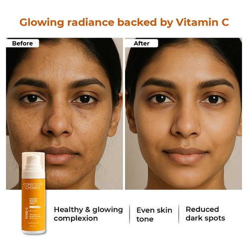 Conscious Chemist Vitamin C 10% Face Serum - Brightening & Anti-Aging Formula | 30ml | Reduces Dark Circles & Fine Lines for Glowing Skin