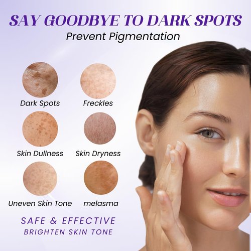 Regine Switzerland Hydraquinon0l Dark Spot Brightening Cream - 4% Non-Irritating Formula for All Skin Types, 1oz