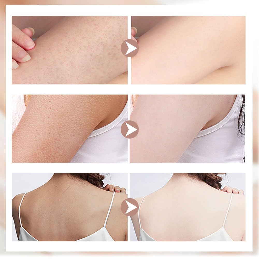 Super Soft Sunflower Suction Cup Bath Ball, 2024 Upgraded 2-in-1 Sunflower Bath Ball Exfoliating Bath Sponge Cleaning Brush, Sponge Mesh Pouf Shower Ball for Women, Men Shower (Colorful-8)