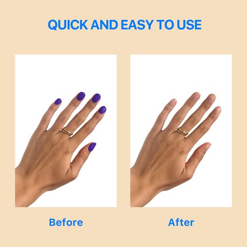 Gentle Touch Non-Acetone Nail Polish Remover | Nourishing Formula | Professional Quality | Rapid Remove | Non-Drying | 8 Fl oz
