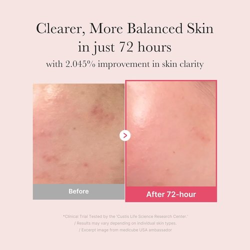 Medicube TXA+Niacinamide 15% Glow Facial Serum - All-in-One Korean Skincare for Uneven Skin Tone | 1.01 fl. oz.