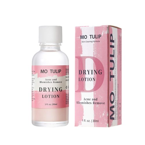 MO TULIP Acne Drying Lotion - Overnight Spot Treatment for Face & Body | 1 oz Pimple & Blemish Solution