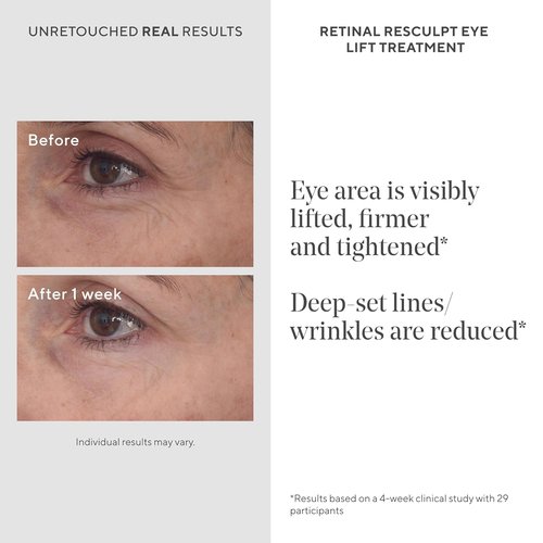 Murad Retinal ReSculptors - 2-Piece Anti-Aging Serum & Eye Cream Kit | Lifts, Firms, Reduces Wrinkles