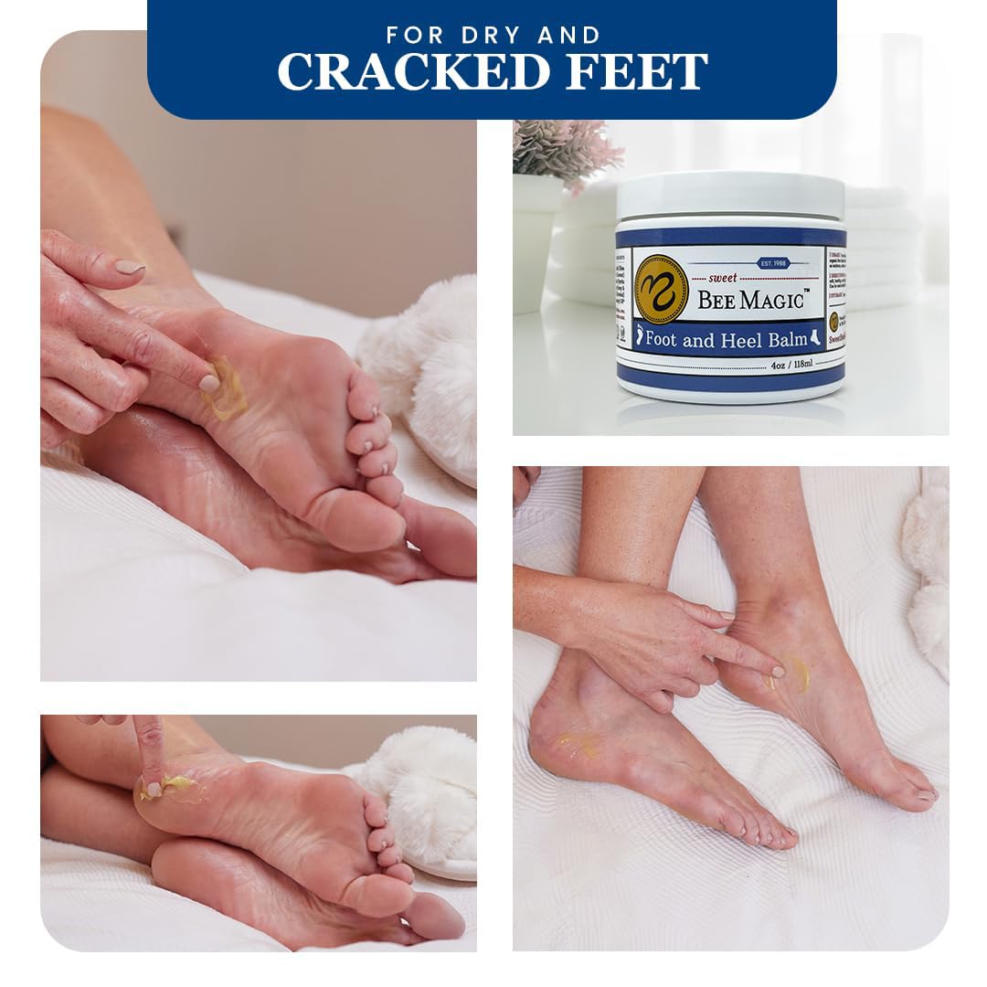 Sweet Bee Naturals Organic Foot Balm - Intensive Moisturizing Treatment for Dry, Cracked Heels - 4 OZ Jar