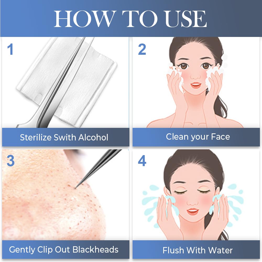 Medical Grade Stainless Steel Blackhead Remover Tools Extraction Kit, Professional Blackhead/Whiteheads/Milia/Pimples Remover for Face (9PCS with 15x Magnifier)