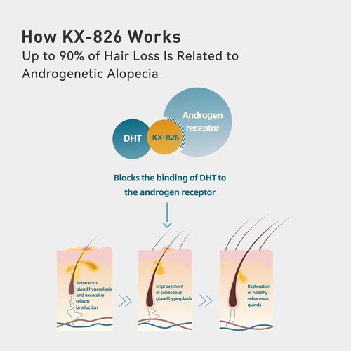 KINTOR Hair Regrowth Spray - 0.9% KX-826 Formula for Healthy Hair Growth | Oil Control, 60ml