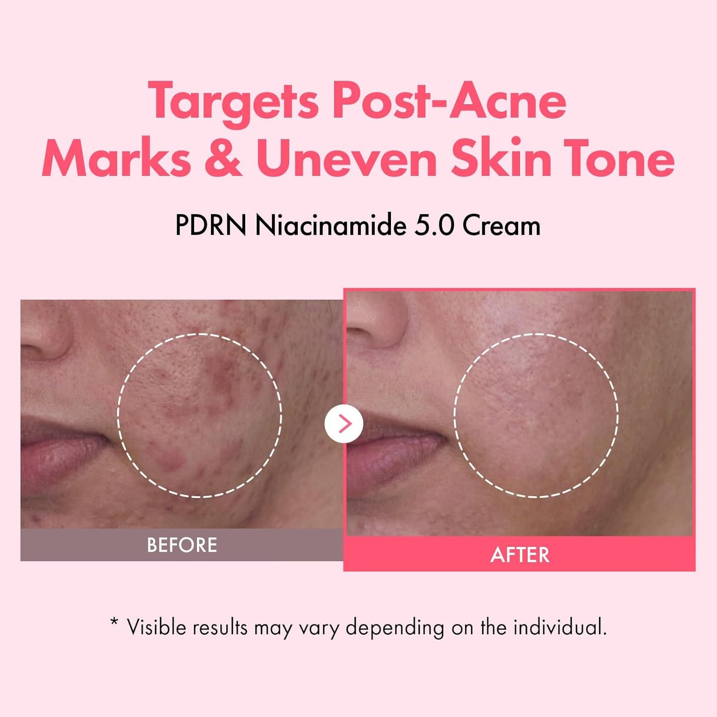TOSOWOONG PDRN Niacinamide 5% Cream - Dark Spot Remover & Hydrating Moisturizer | 50ml Korean Skincare