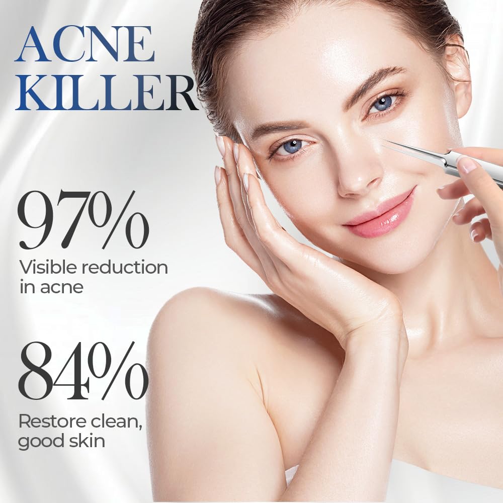 Medical Grade Stainless Steel Blackhead Remover Tools Extraction Kit, Professional Blackhead/Whiteheads/Milia/Pimples Remover for Face (9PCS with 15x Magnifier)