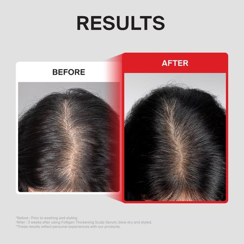 Dr.FORHAIR Folligen Thickening Scalp Serum - Biotin Density Treatment for Thicker, Fuller Hair | 1.7 oz