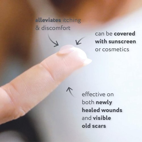 ScarAway Acne Scar Treatment, Clear Silicone Scar Gel, 100% Medical-Grade, Helps Improve Size, Color & Texture of Post-Acne Hypertrophic & Keloid Scars on Face & Body, Water Resistant, 15 grams