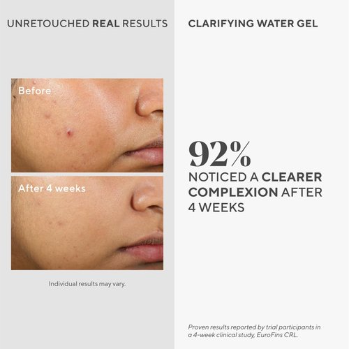Murad Clarifying Water Gel - Lightweight Moisturizer for Acne-Prone Skin with Salicylic Acid | 2 Fl Oz