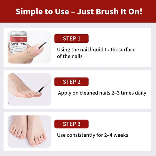 Regine Switzerland Toenail Fungus Treatment - Extra Strength Antifungal Nail Repair with Undecylenic Acid | 30ml