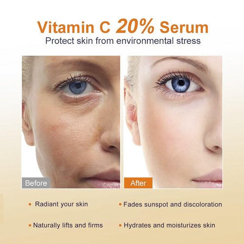 Regine Switzerland Vitamin C Serum 20% - Anti-Aging Face Serum for Radiant Skin & Reduced Fine Lines