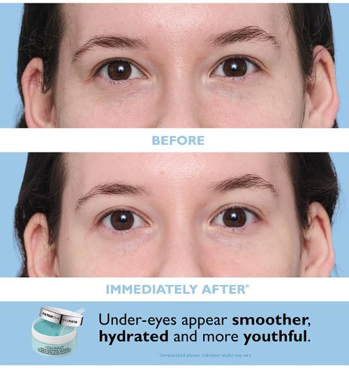 Peter Thomas Roth | Travel Pack Eye Patches for Instant Hydration & Brightening