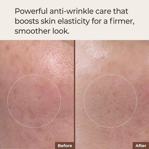 Rbfy. Core Vita Radiance Ampoule - 17% Pure Vitamin C Face Serum for Radiant Skin, Dark Spot Reduction and Wrinkle Care | Anti Aging, Dermatologically Tested, Korean Skincare (1.01 fl oz)