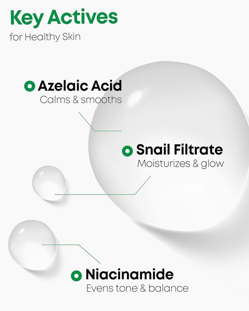 Nineless A-Control Azelaic Acid Toner - Pore Refining & Soothing for Acne-Prone Skin | 5.07 fl. oz