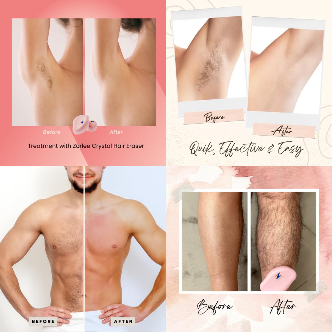 Crystal Hair Remover for Women and Men, Reusable Crystal Hair Eraser Magic Painless Exfoliation Hair Removal Tool, Magic Hair Eraser Device for Back Arms Legs (Pink)