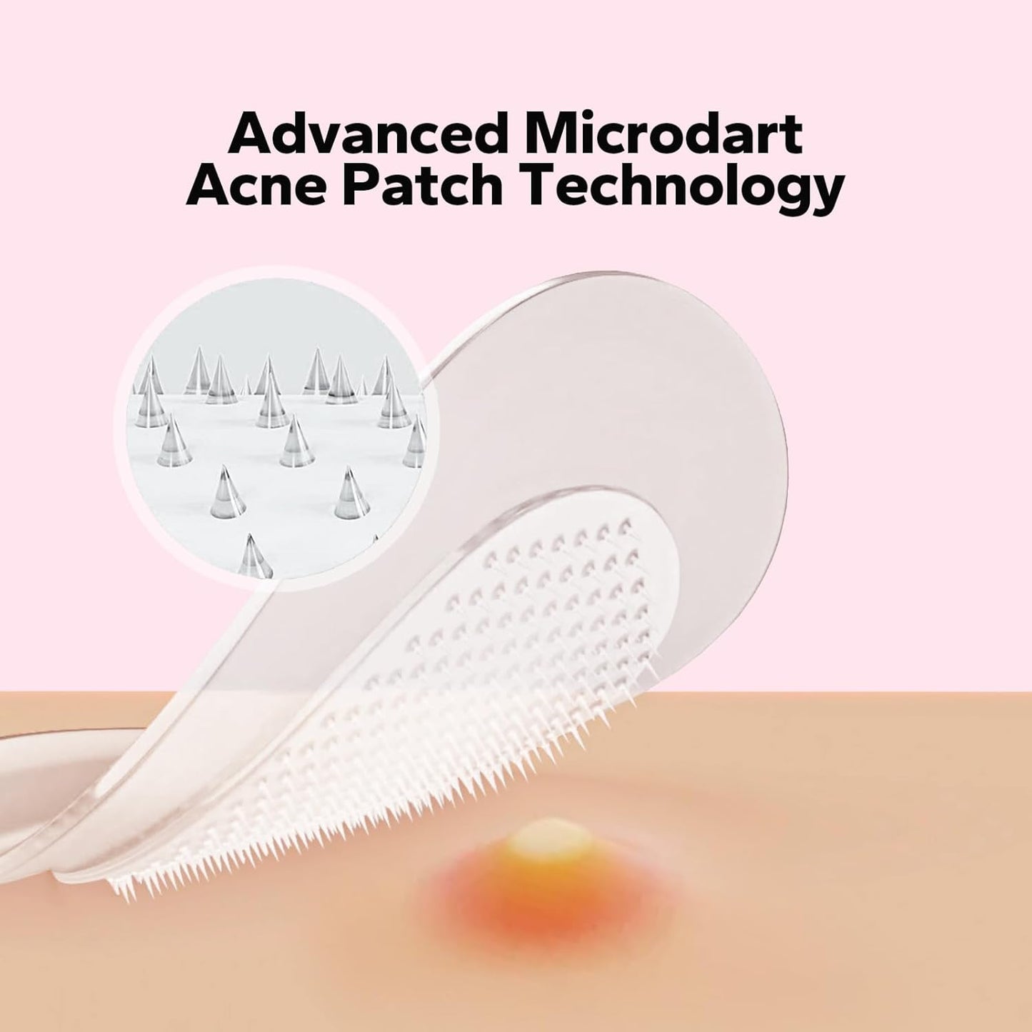 Skiennix Pimple Patches - Fast-Acting Microdart Acne Treatment with Salicylic Acid | 18 Count