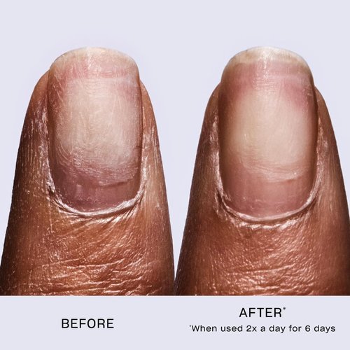 OPI Repair Mode Nail Serum - Keratin Protein Treatment for Stronger Nails & Growth