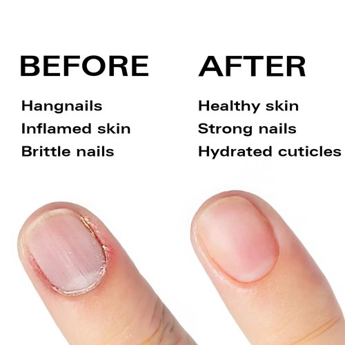 Beauty Power Nail Oil Cuticle Pen - Lemon - Nail Strengthener & Growth Serum with Vitamin A, D, E, B5, Grapeseed & Natural Oils - Repair for Brittle, Peeling, Thin Nails - Gift Idea