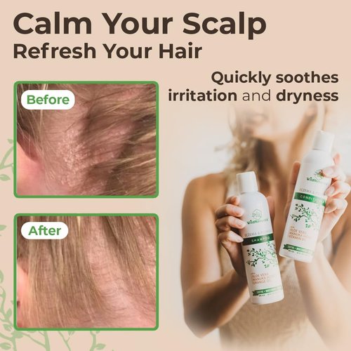 Regine Switzerland Eczema Psoriasis Shampoo & Conditioner Set - Anti-Dandruff Treatment for Itchy Scalp