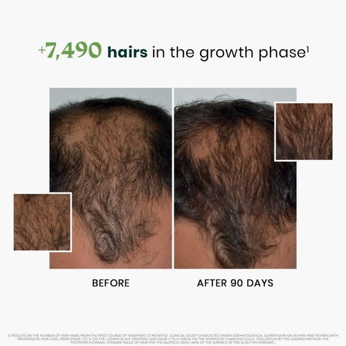 Rene Furterer Triphasic Serum for Thinning Hair - Drug-Free Leave-In Treatment | 30-Day Supply, 8 ct.
