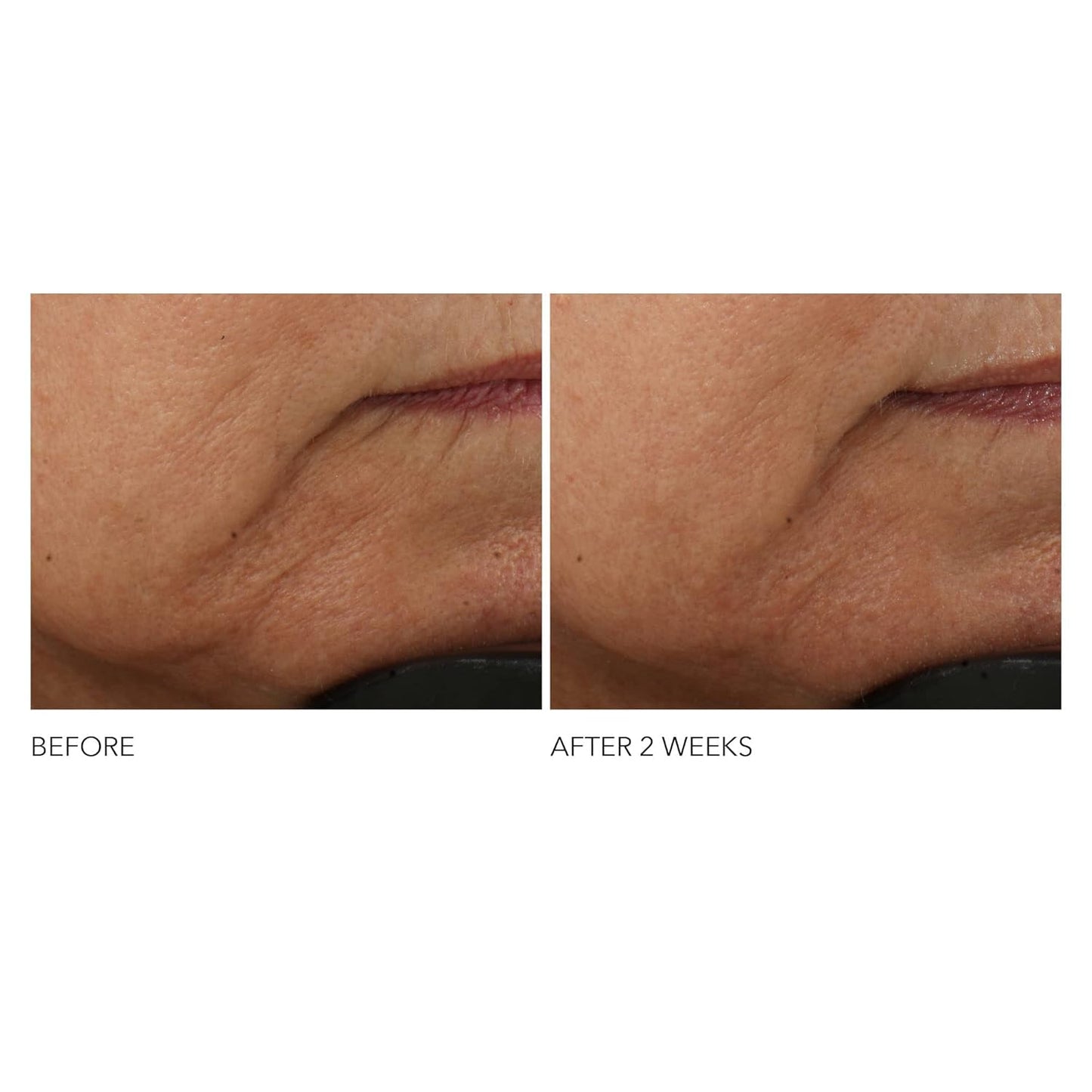 Dr. Dennis Gross Advanced Retinol + Ferulic Wrinkle Cream - Intensely Hydrating Skin Repair | 2 oz