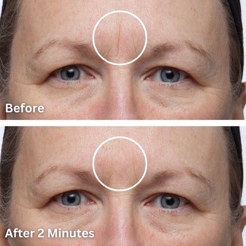 Dermaflage Scar Filler - Refill Applicator for Flawless Skin | Easy Application