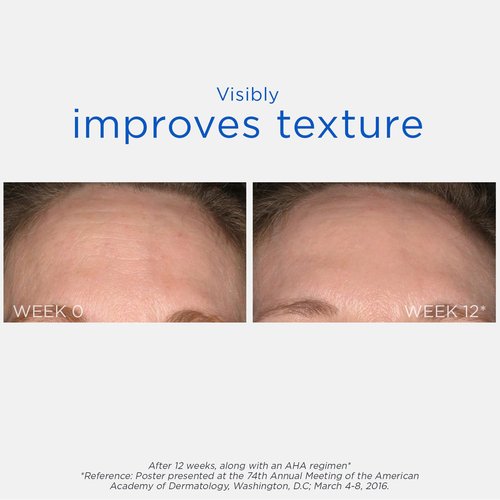 NEOSTRATA Glycolic At-Home Chemical Peel - High-Strength Exfoliating Treatment, 2 fl. oz.