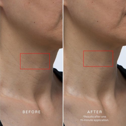 Karuna Collagen Neck & Chest Hydrogel Mask - Firming & Hydrating K-Beauty Treatment | 1-Pack for Wrinkles & Sagging Skin