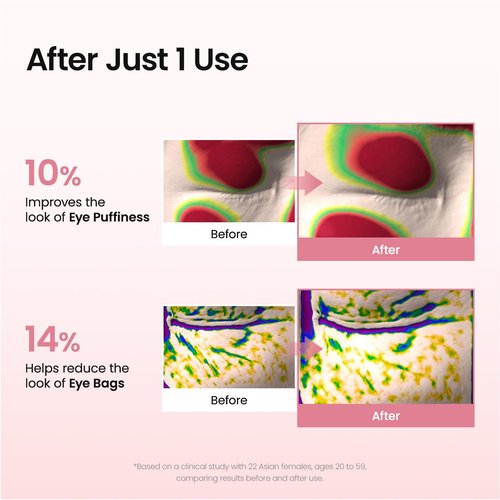 BIODANCE Collagen Peptide Eye Patches - Anti-Wrinkle & Smile Line Treatment | 60 Count Under Eye Masks