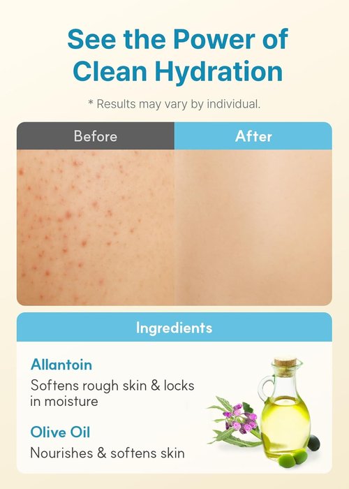 Derma B Daily Moisture Body Lotion - Long-Lasting Hydration for Dry, Sensitive Skin | 13.5 fl oz (400ml)
