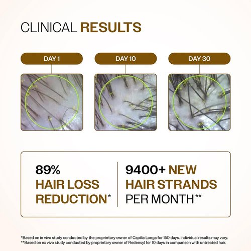 Bare Anatomy Advanced Hair Density Serum - Boosts Hair Density with Redensyl & Anagain | Reduces Hair Fall for All Hair Types