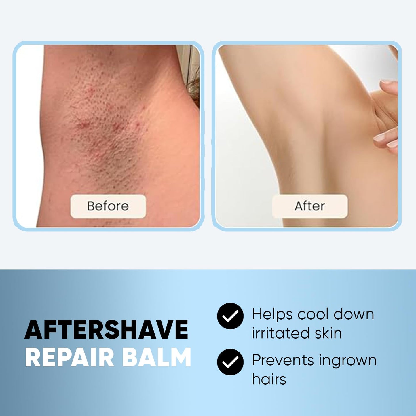 Razor Bump Stopper Solution for Ingrown Hair Skin Care Treatment for Face, Neck, Bikini Area, Legs and Underarm Area After Shave Serum Roll-On for Men and Women With Salicylic Acid, Glycolic Acid