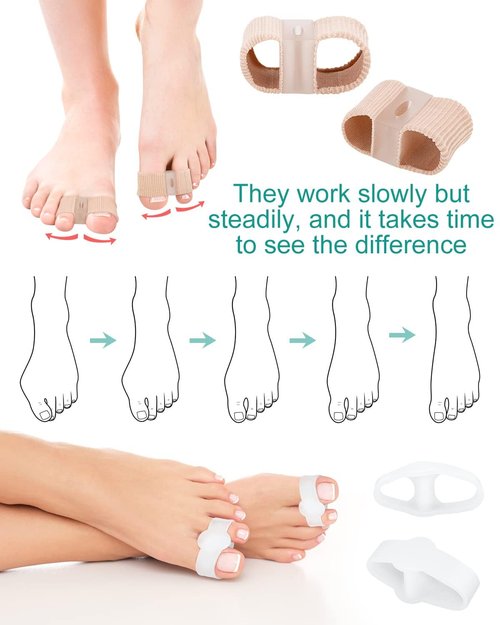 BLATOWN 4Pcs Toe Separators Bunion Corrector for Women Men, Gel Big Toe Spacers with 2 Loops for Feet, Hammer Toe Straightener, Elasticity and Soft (2Nylon+2Gel)
