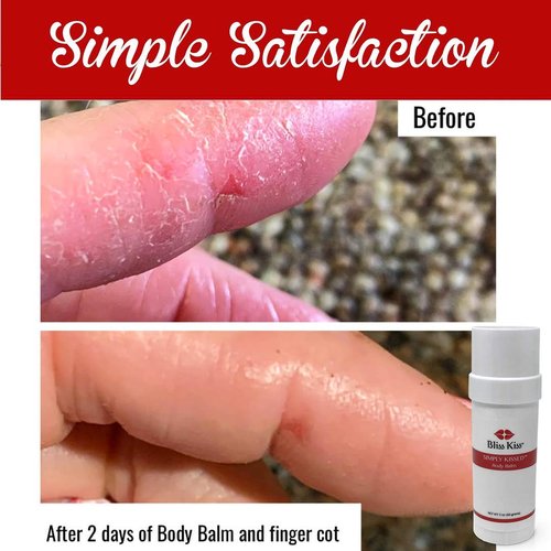 Bliss Kiss Simply Kissed Ultra Hydrating Body Balm for Dry Cracked Skin