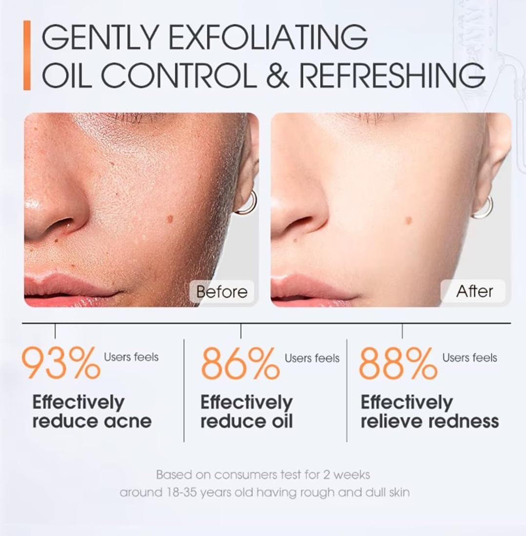 SKINEVER Salicylic Acid Face Exfoliating Scrub - Deep Cleanse & Smooth Skin Texture | 75 ML
