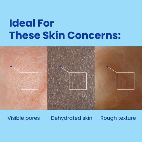 Regine Switzerland Hyaluronic Squalane Microshot Cream - Pore Refining & Deep Hydration for Radiant Skin - 1.75 fl. oz (50ml)